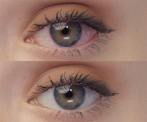 Average results before and after using LUMIFY eye drops on blue eyes. Before shows an eye with redness and after shows the same eye but with whiter, brighter whites of the eyes.