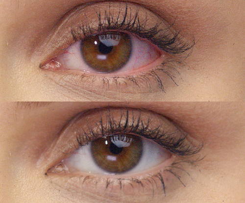 Average results before and after using LUMIFY eye drops on light brown eyes. Before shows an eye with redness and after shows the same eye but with whiter, brighter whites of the eyes.